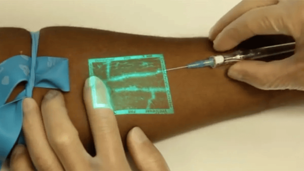 El dispositivo que utiliza luz infarroja para detectar venas, revolucionó uno de los procedimientos más frecuentes en la salud.