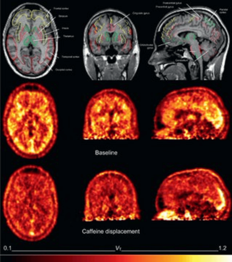   <a href='https://www.cronica.com.ar/tags/Café'>Café</a>: así actúa en el cerebro. 