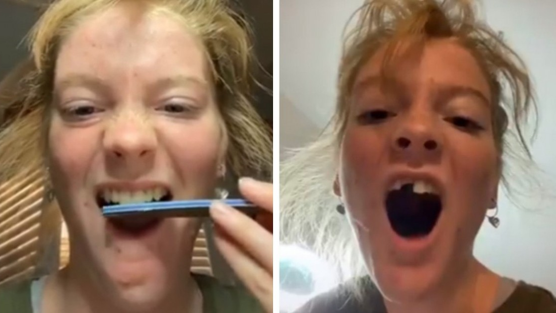 El reto viral de Tiktok que puede arruinar tus dientes es la moda en la red social.