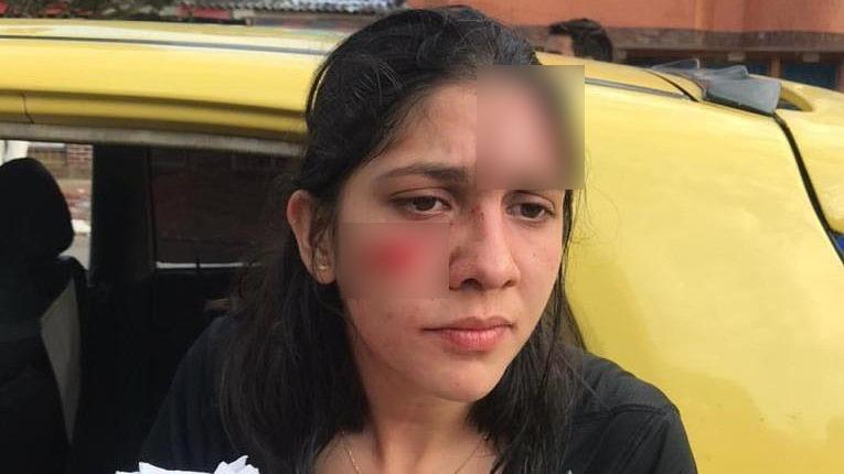 Diana Carreño, la joven de 27 años, agredida por dos hombres en Colombia (Instagram)