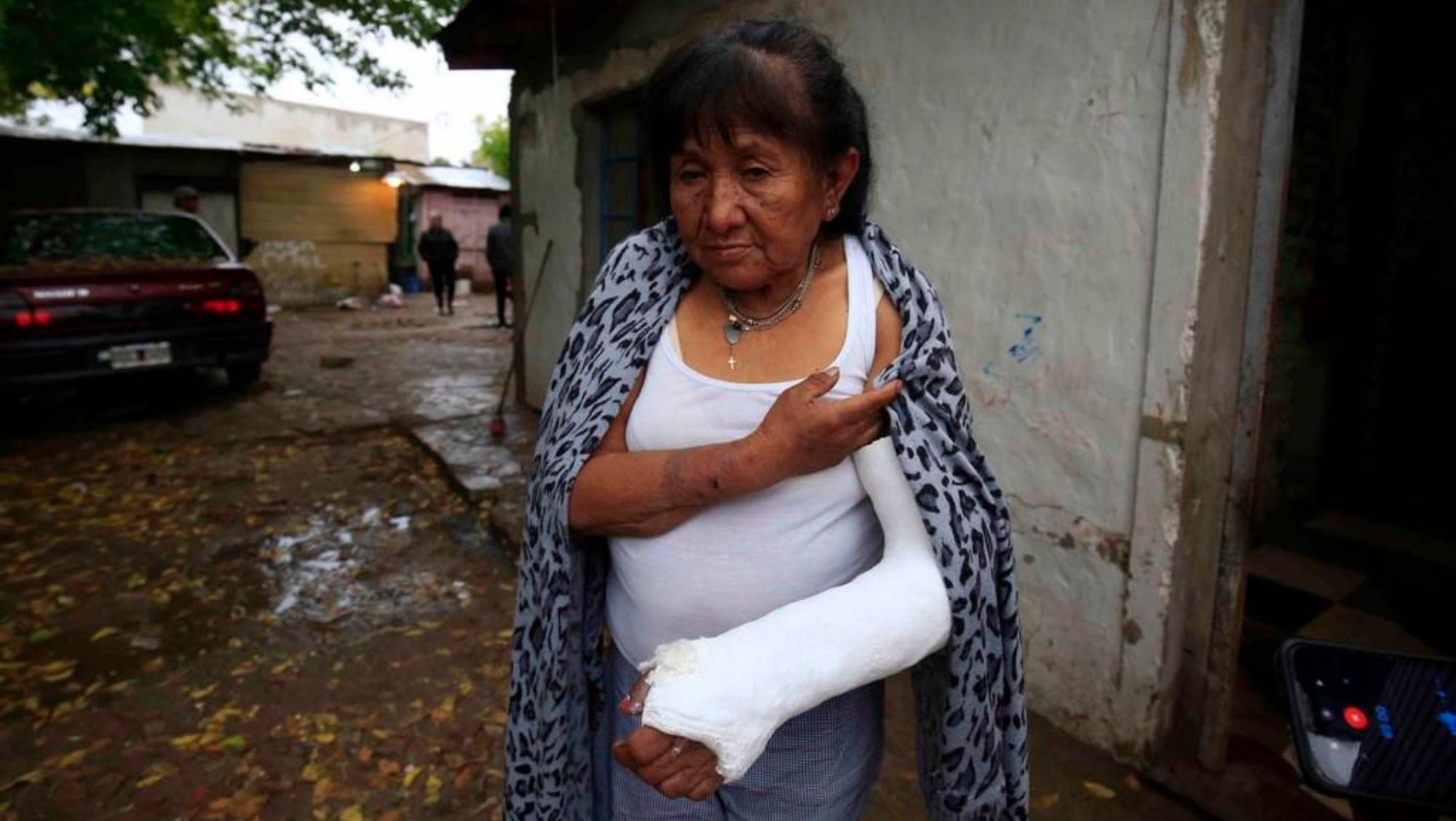 La dueña de casa terminó con un brazo roto y heridas varias (Gentileza El Día)