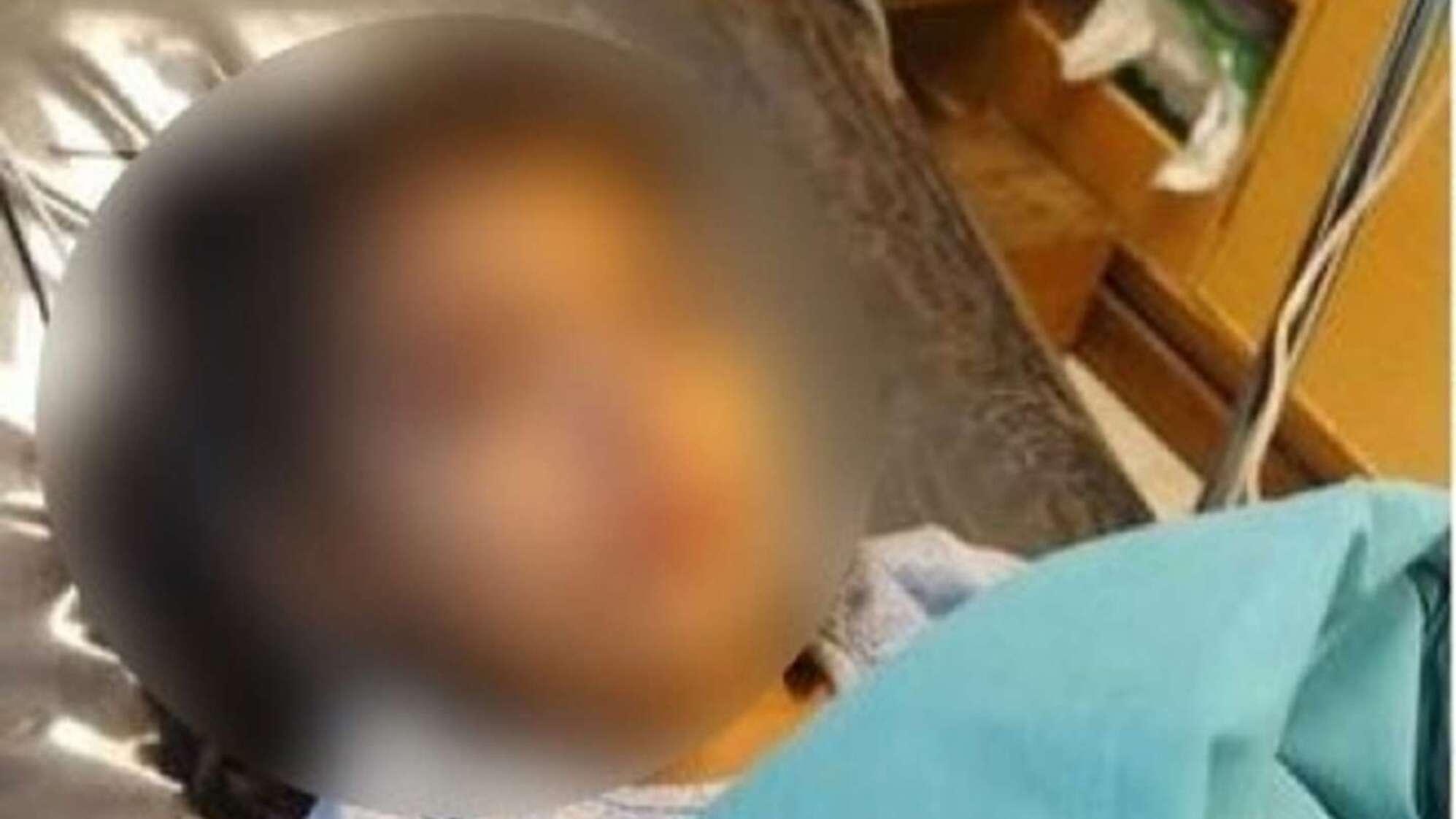 La menor que fue hospitalizada por el desafío de Tik Tok, recibió el alta.