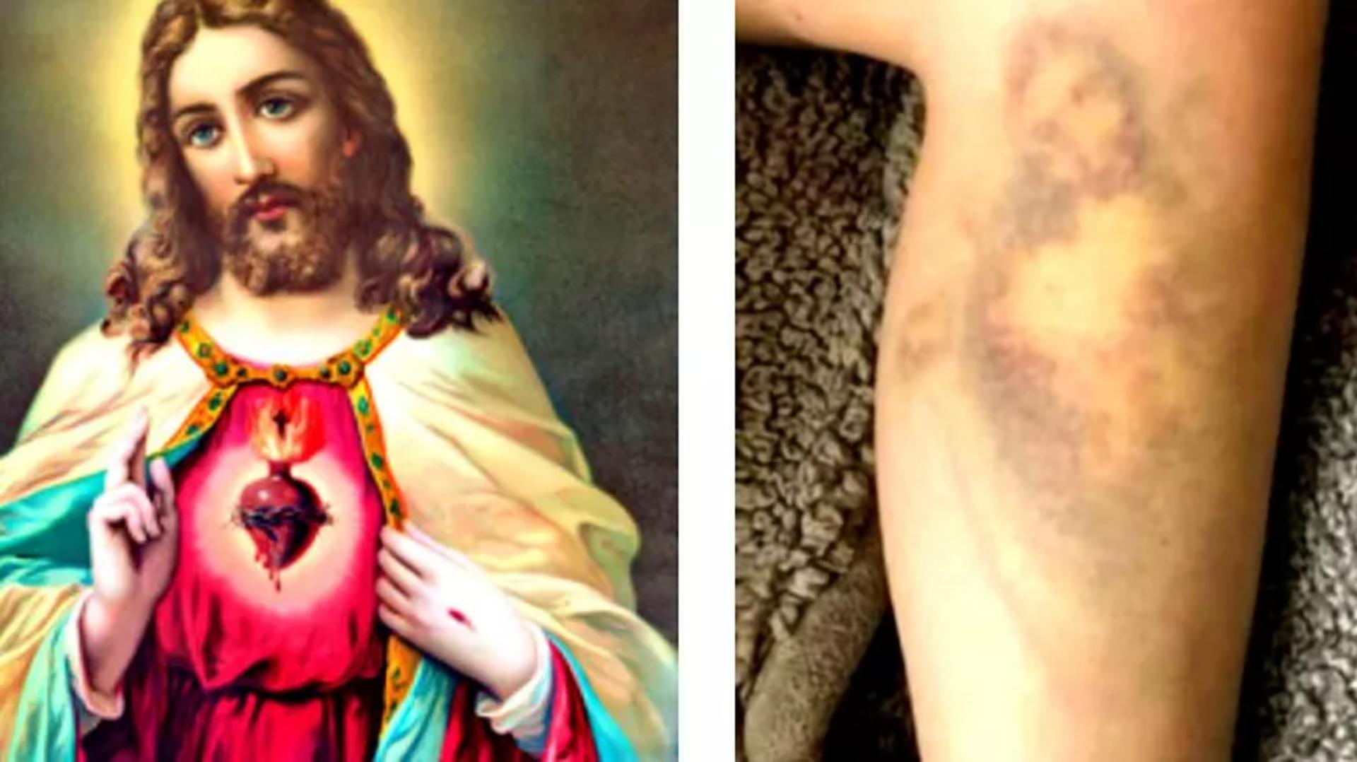 ¿Verdad o truco? La imagen religiosa y el hematoma, casi iguales (Gentileza Pulzo).