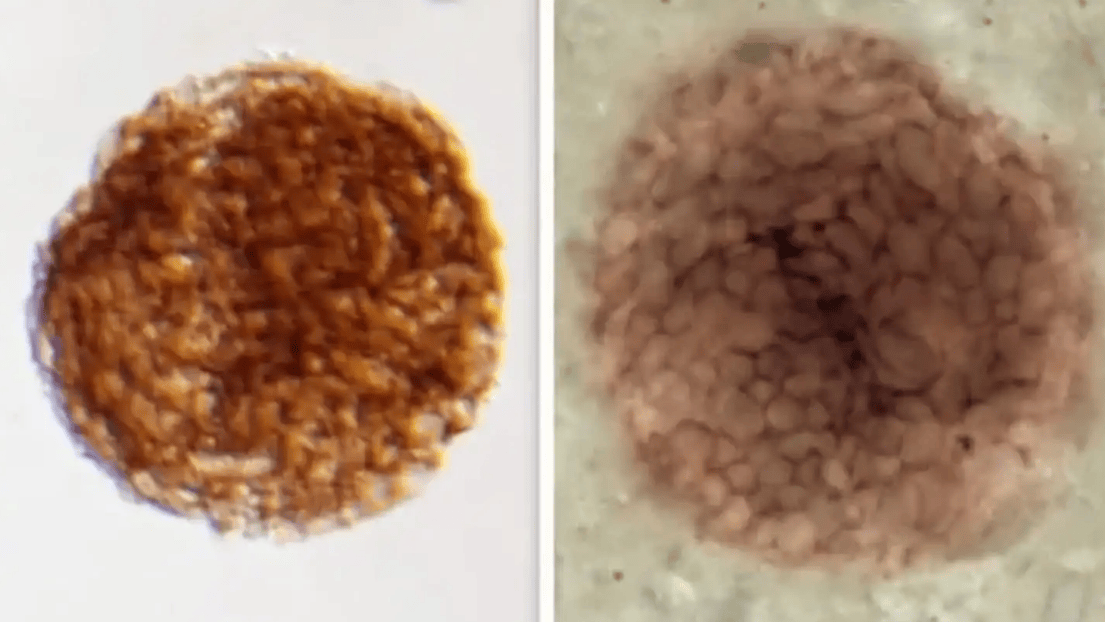 El Bicellum Brasieri tiene dos diferentes tipos de células (imagen gentileza de Current Biology).