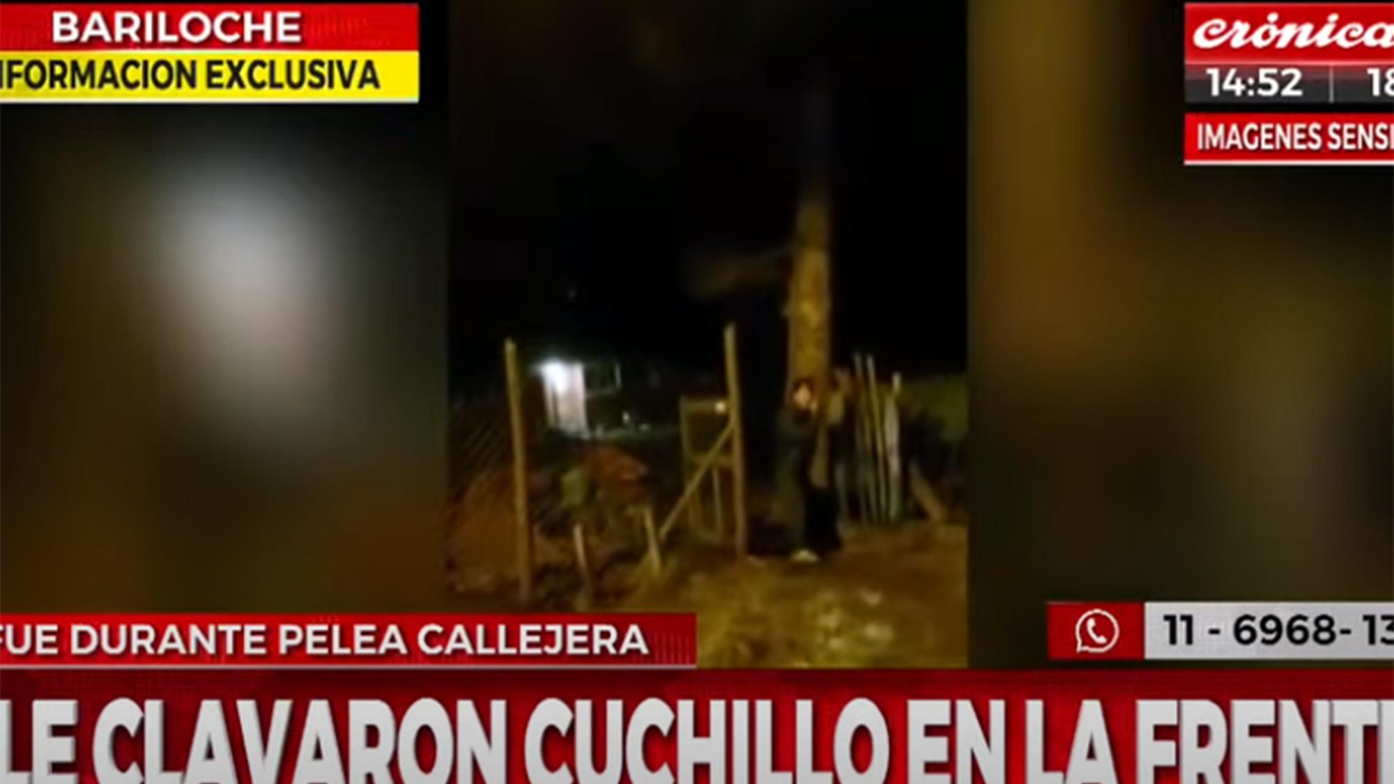 Así le clavaron un cuchillo en la frente durante pelea callejera.