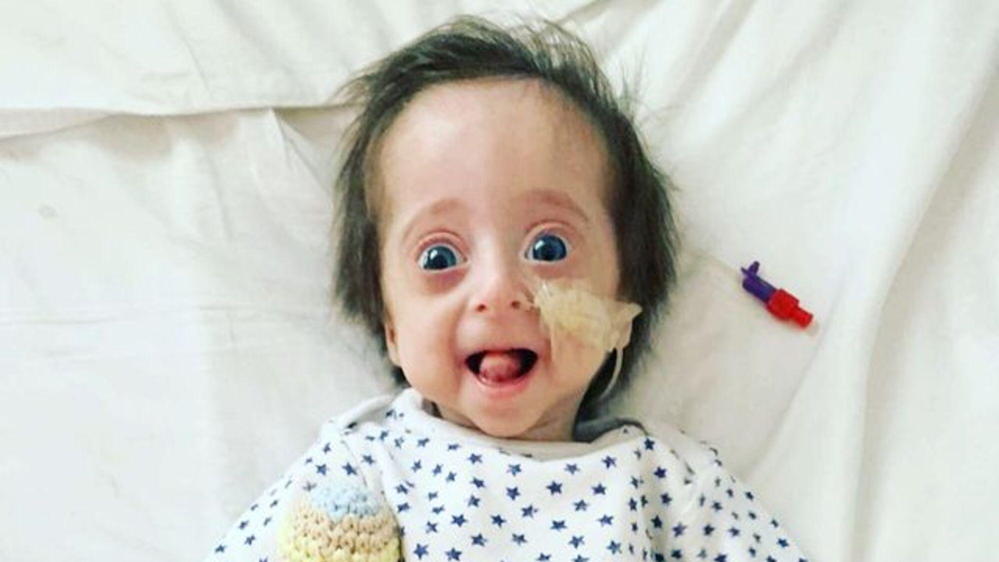 Vito Rodríguez March, el nene que padece progeria.