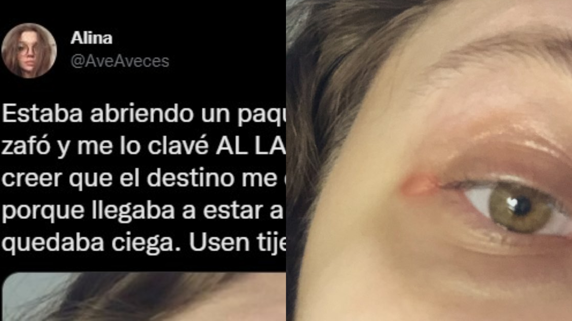 La experiencia de una mujer al abrir un paquete con un cuchillo.