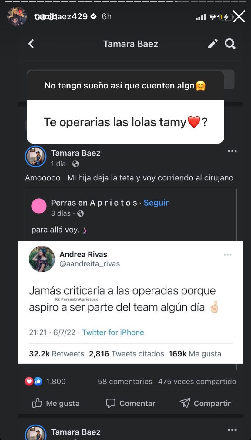 La nueva cirugía de Tamara Báez, la novia de L-Gante.