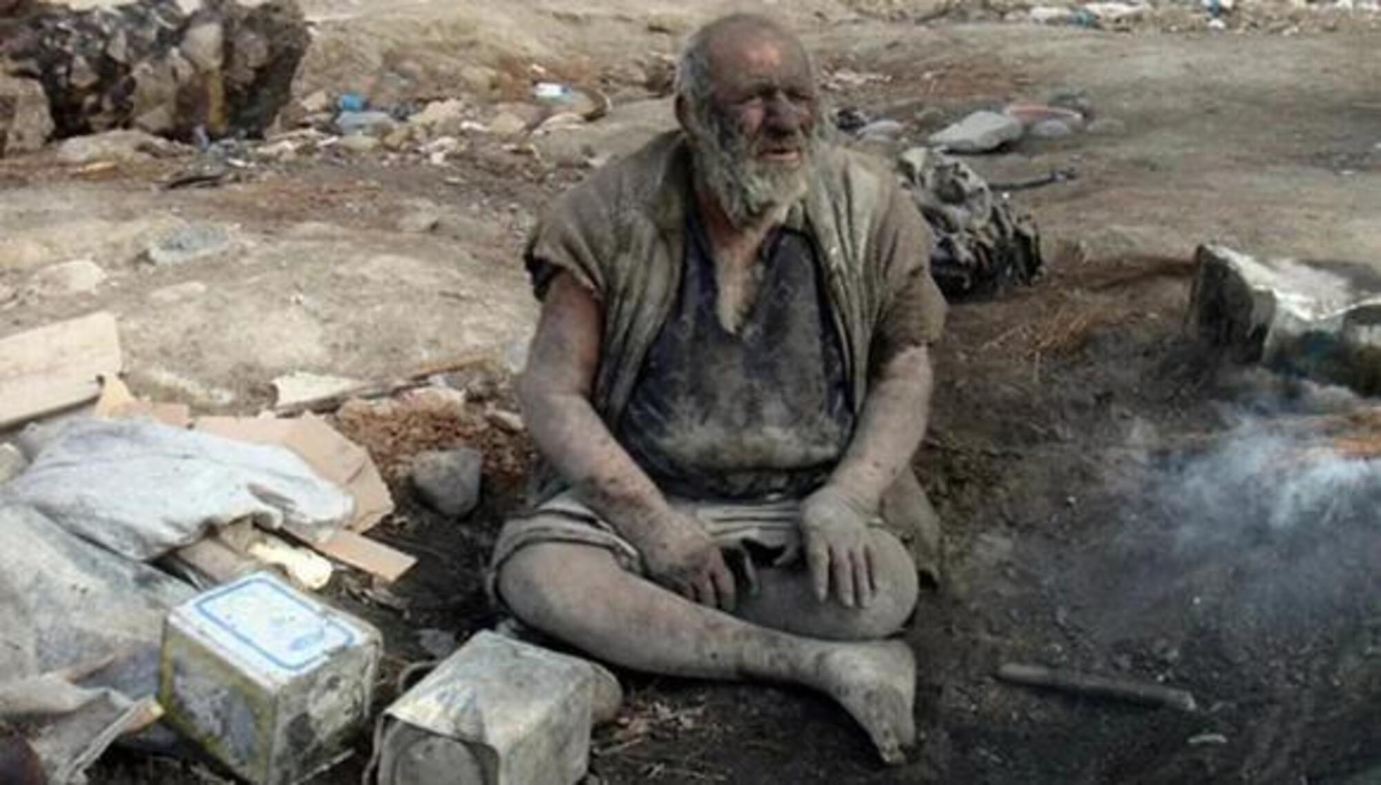  Un hombre lleva casi 70 años sin bañarse y a pesar de que vive en la basura, su estado de salud sorprende a los médicos.