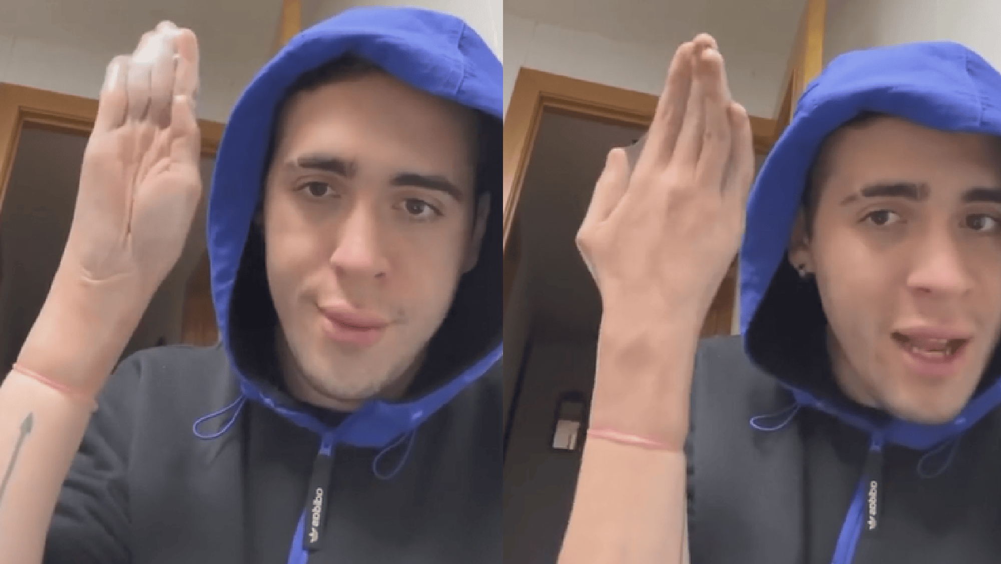 Un joven intentó mostrar en TikTok cómo se estira un preservativo, pero se volvió viral por un increíble detalle.