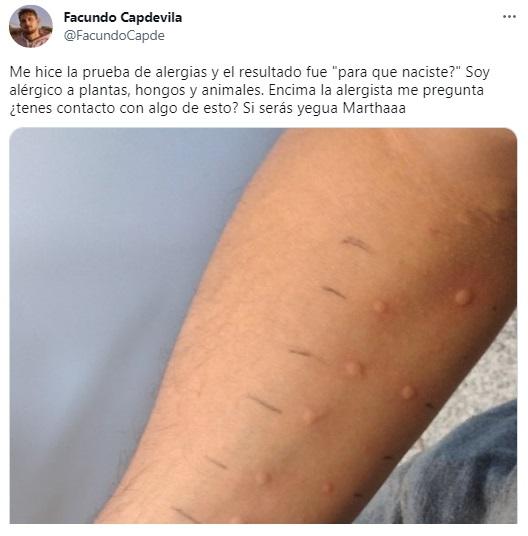 El tuit del joven que se volvió viral al contar a qué es alérgico.