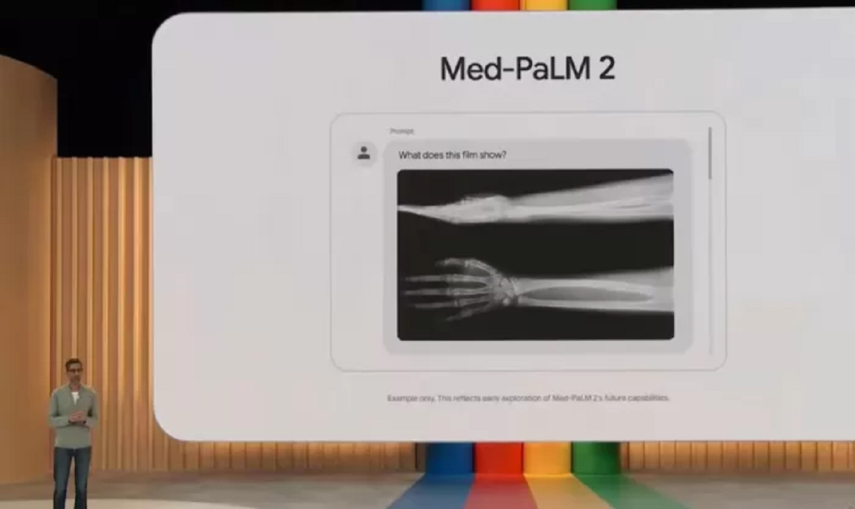 'Med-PaLM 2', la inteligencia artificial para la salud.