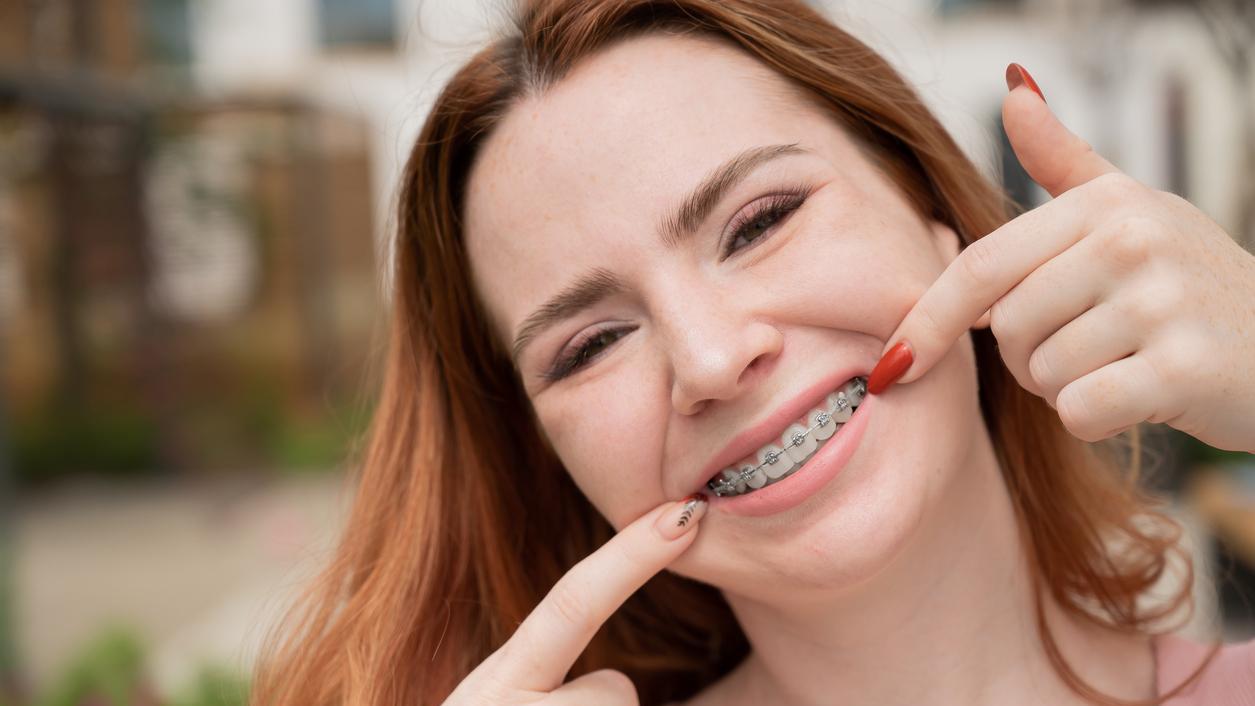 Una marca de brackets fue prohibida por el ANMAT (Imagen ilustrativa).